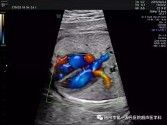 我院引进高端妇产超声专用机助力筛查胎儿先天性心脏病