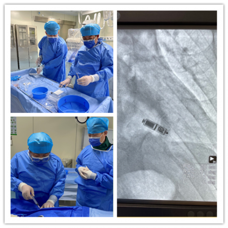 “小身材 大能量”——市一院心内科团队运用微创技术经导管将形似“胶囊”的新型无导线起搏器植入83岁患者心腔