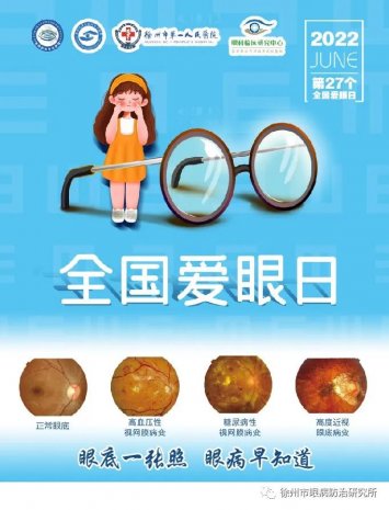 我院职工眼健康筛查活动反馈报告