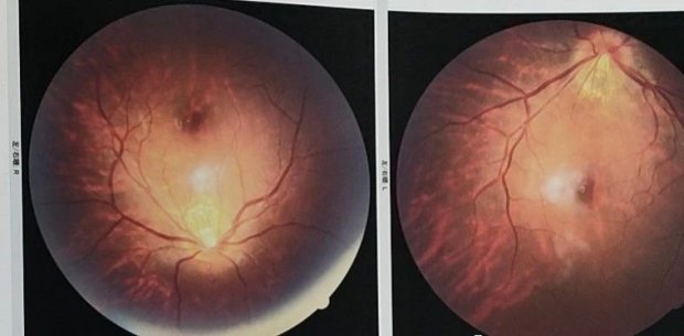 豹纹=​时尚？这种豹纹出现需警惕！