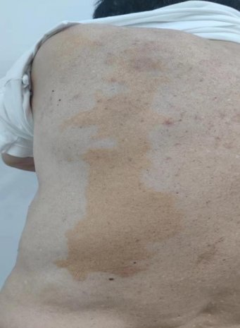 健康科普 | 身体抱恙 皮肤先知